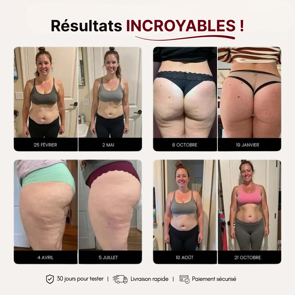 Legging 3D Anti-Cellulite